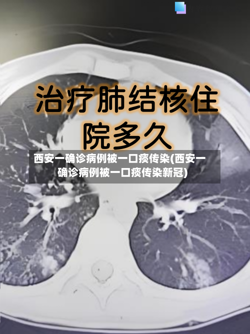 西安一确诊病例被一口痰传染(西安一确诊病例被一口痰传染新冠)-第3张图片