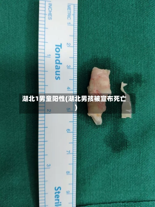 湖北1男童阳性(湖北男孩被宣布死亡)-第3张图片