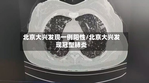 北京大兴发现一例阳性/北京大兴发现冠型肺炎-第2张图片