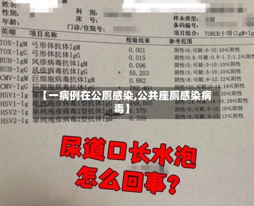 【一病例在公厕感染,公共座厕感染病毒】-第2张图片