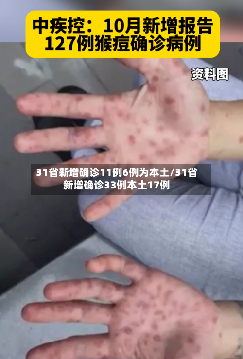 31省新增确诊11例6例为本土/31省新增确诊33例本土17例-第3张图片