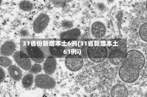 31省份新增本土6例(31省新增本土61例i)-第2张图片